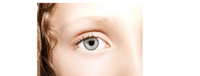 症状|卢老大课堂:出现睁眼困难、眼睑下垂谨慎—眼肌型重症肌无力!