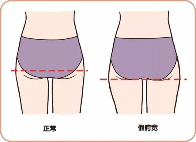 显得|分得清胯宽和假胯宽吗？拯救你的假宽胯穿搭技巧！