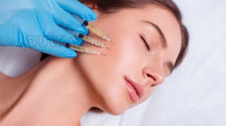 注入|面部美容填充、脂肪填充多久可以补第二次填充
