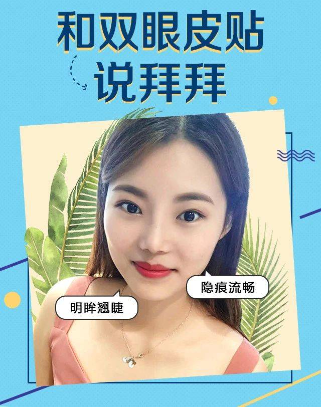制定方案|温州艺星整形：我的双眼皮贴把男朋友吓到了！