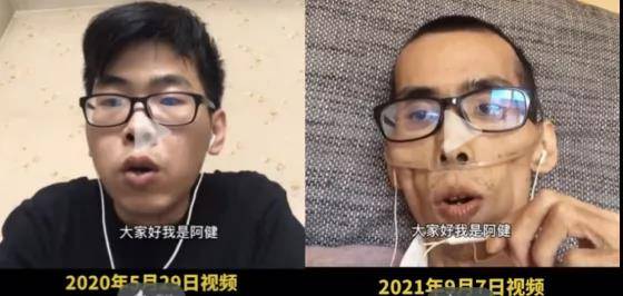 阿健|“癌症病人最后是饿死的？”所言非虚？省肿瘤医院李涛：重视这种治疗，还有救