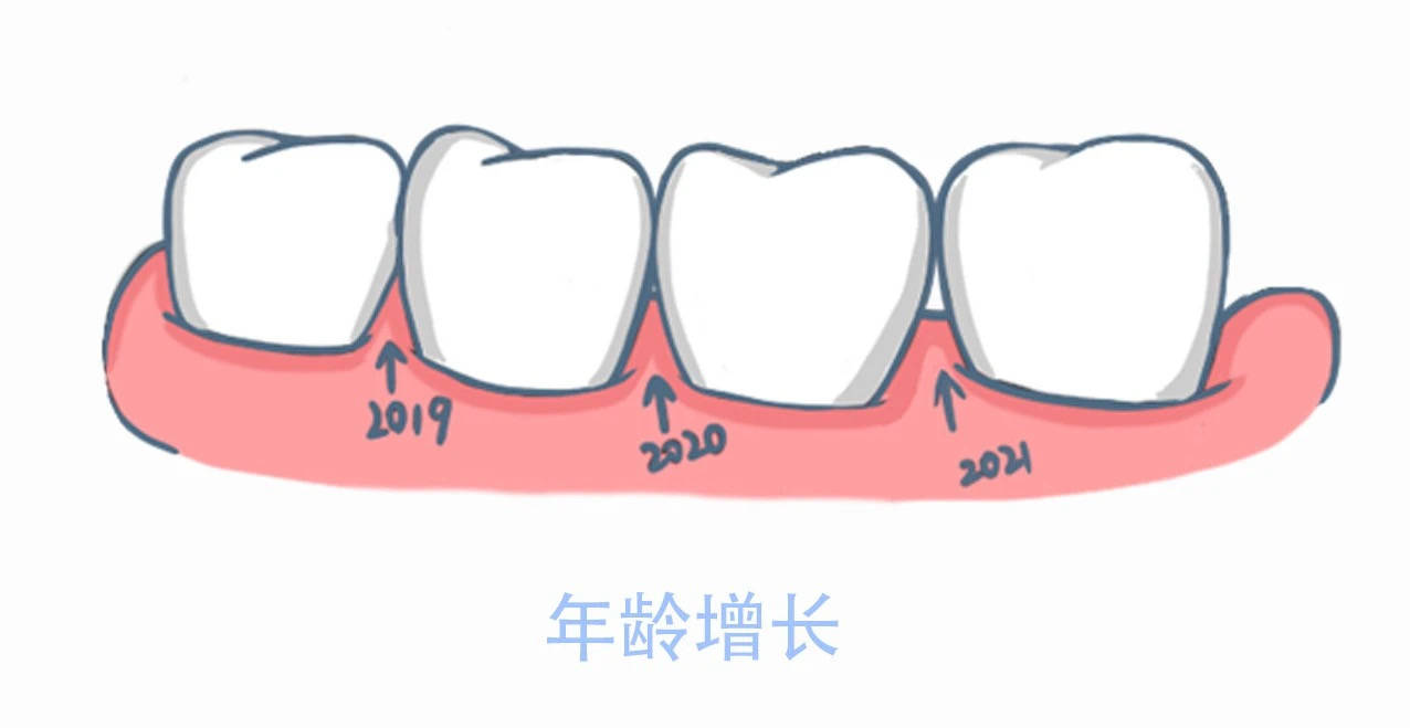 拿什麼拯救你牙齒黑三角