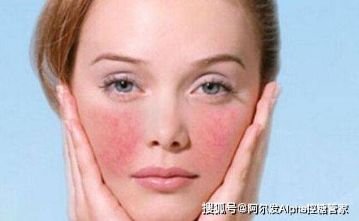 变化|血糖高不高,都写在脸上了