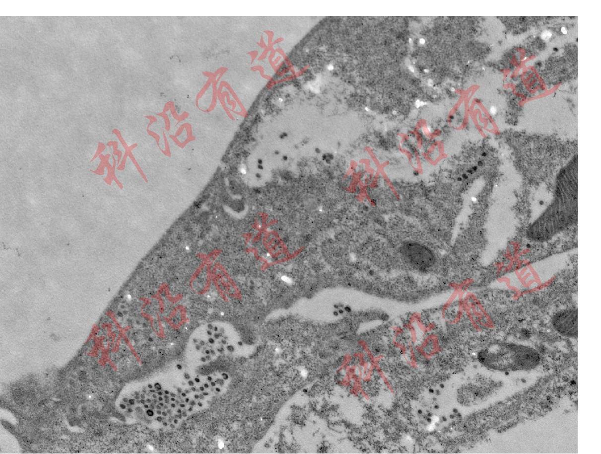 免疫电镜技术简介及样本准备注意事项