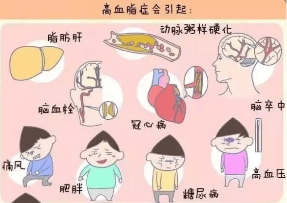 血脂怎样形成的 bd578e9fd8d743999315961df7e04014.png