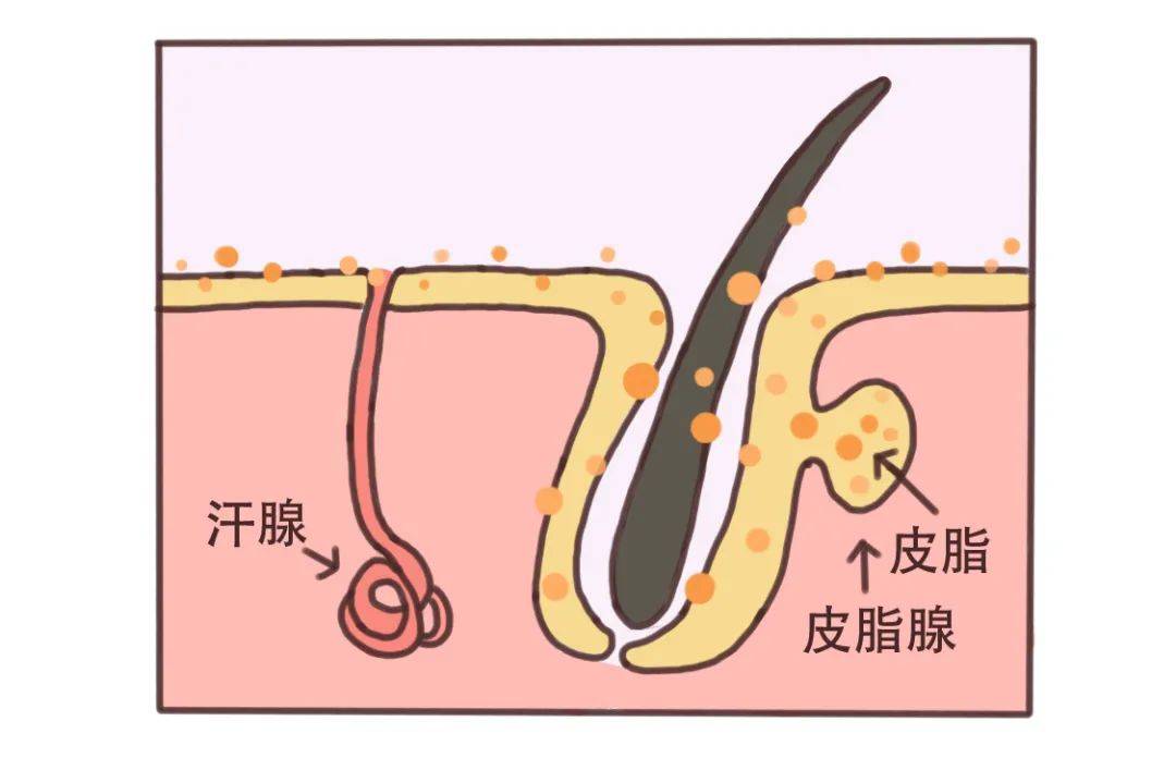 遗传因素2雄性激素3生活习惯4饮食习惯5错误的护肤习惯6