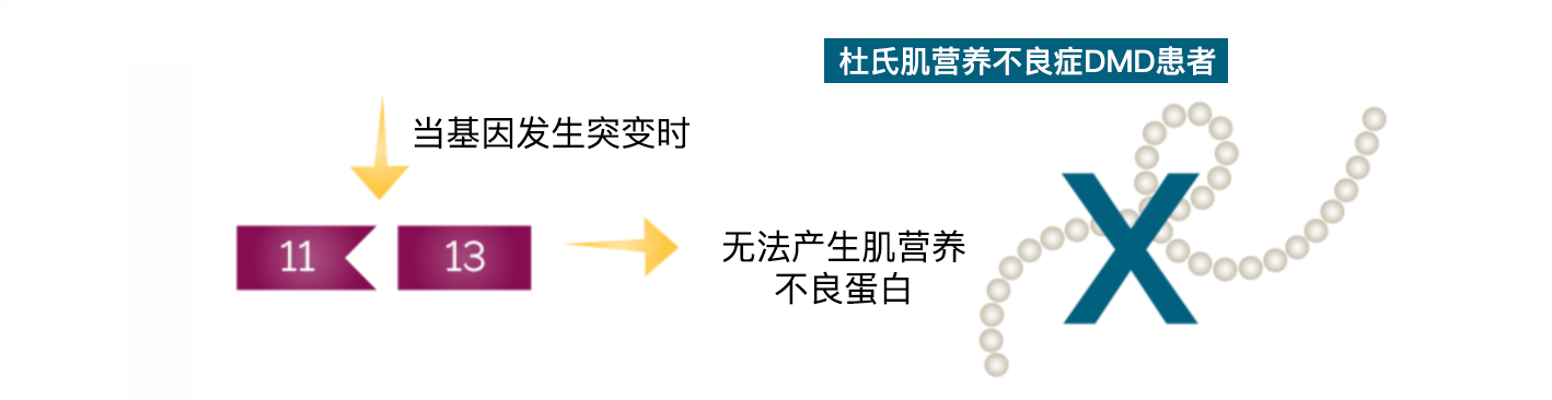 未来基因疗法能否突破限制,挽救杜氏肌营养不良症dmd患者?