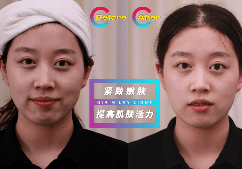何抗光如何抗光老化？NIR牛奶光效果怎么样？