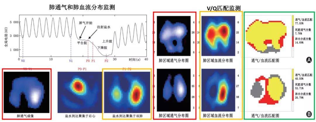 动态|无辐射“动态CT”助力救治多名重症患者
