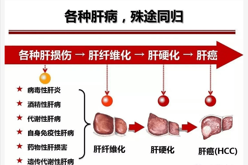 干细胞对肝病治疗的前景