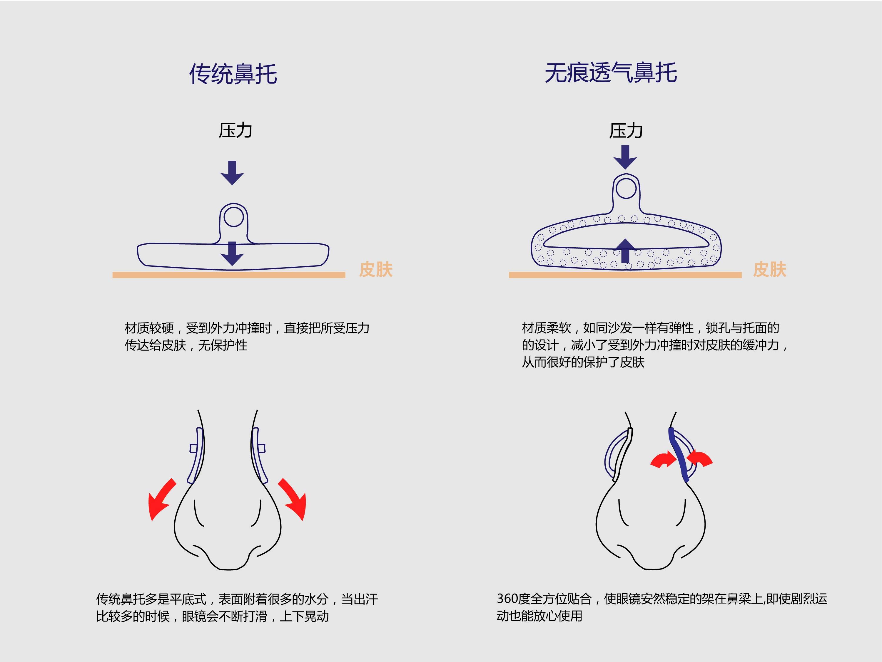 眼睛酸胀干涩疼痛眼镜佩戴不舒服居然是劣质眼镜鼻托污染双眼
