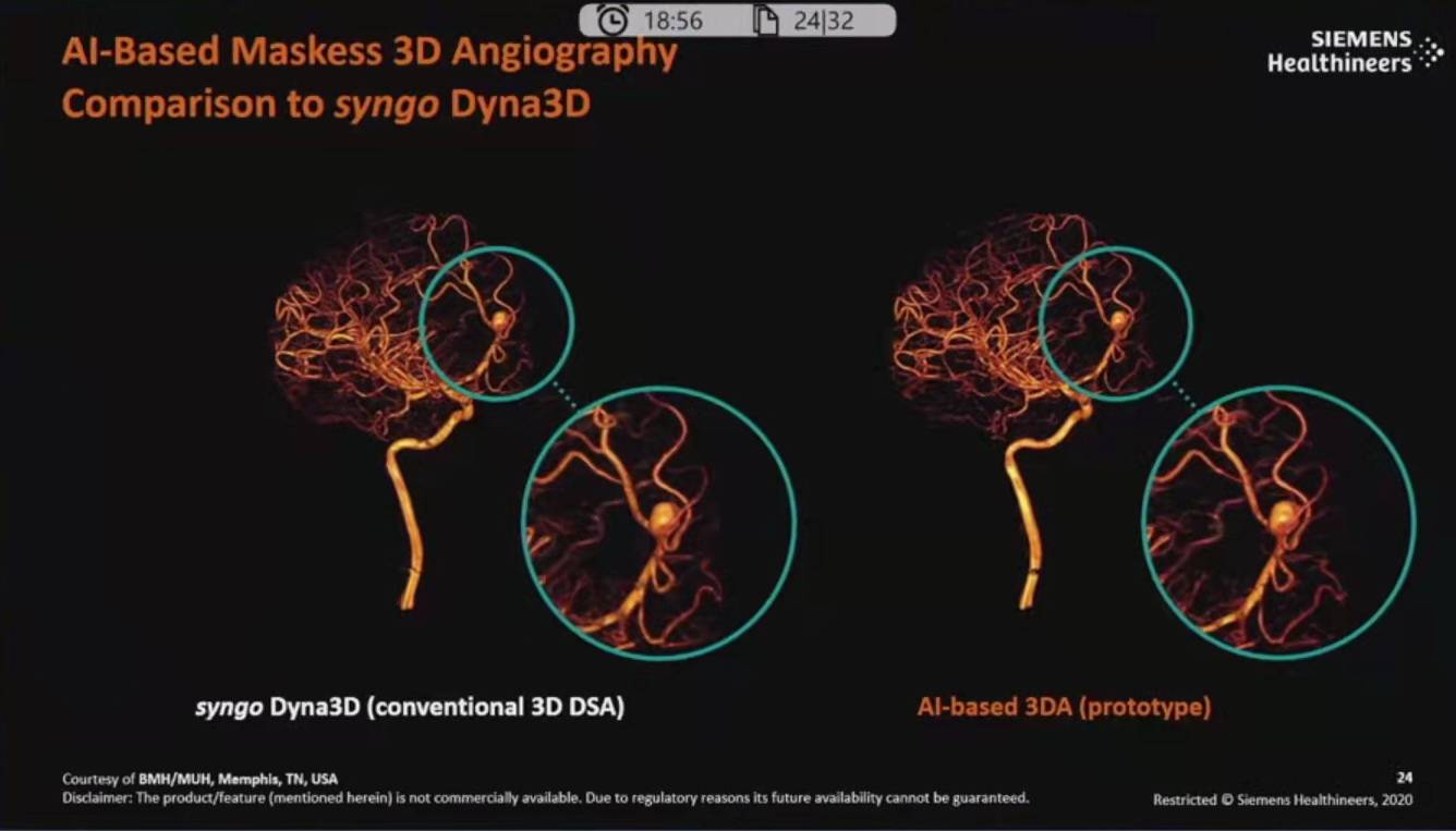 降低|神经介入领域新技术展望