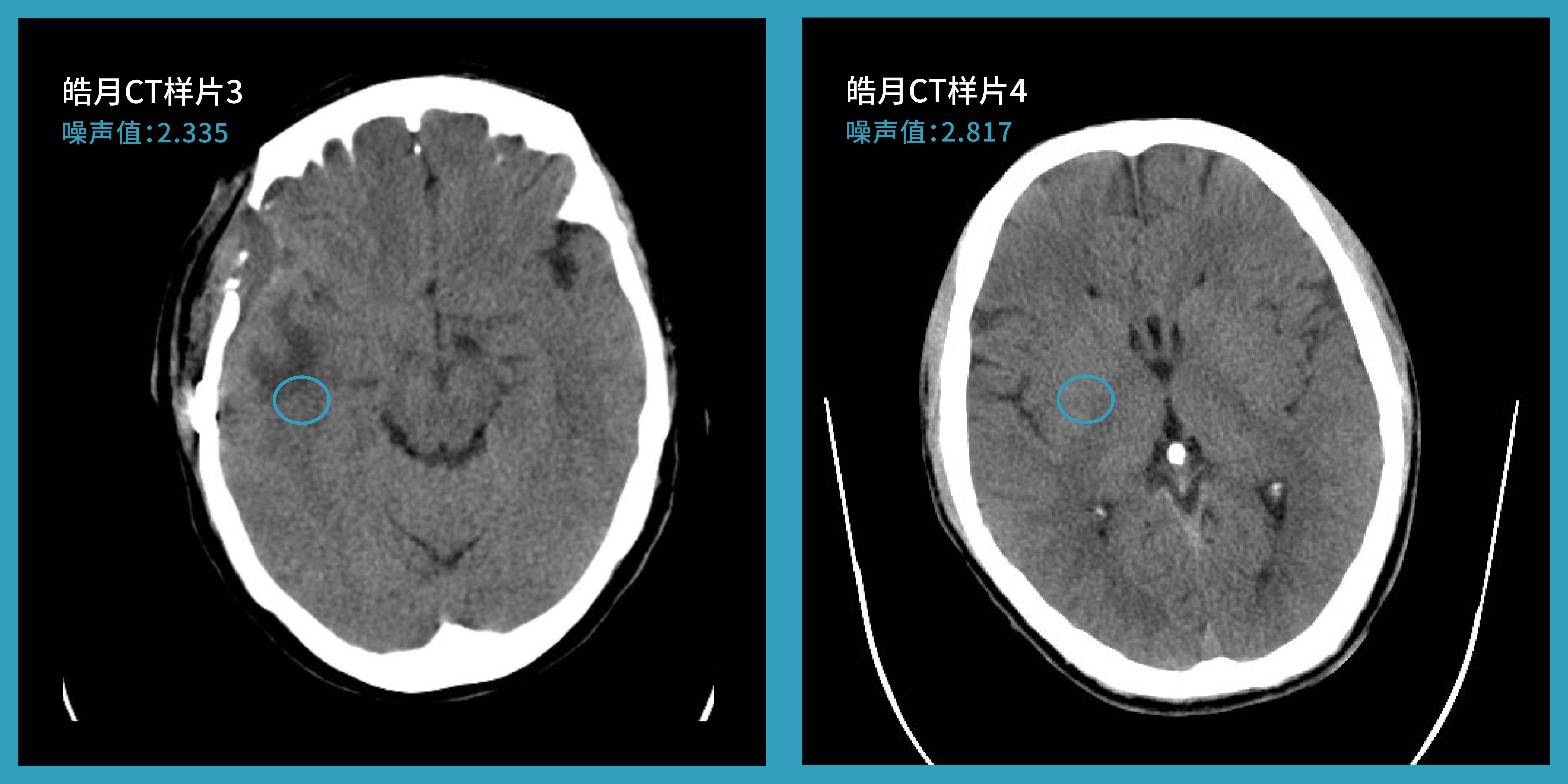 头颅CT片子图片