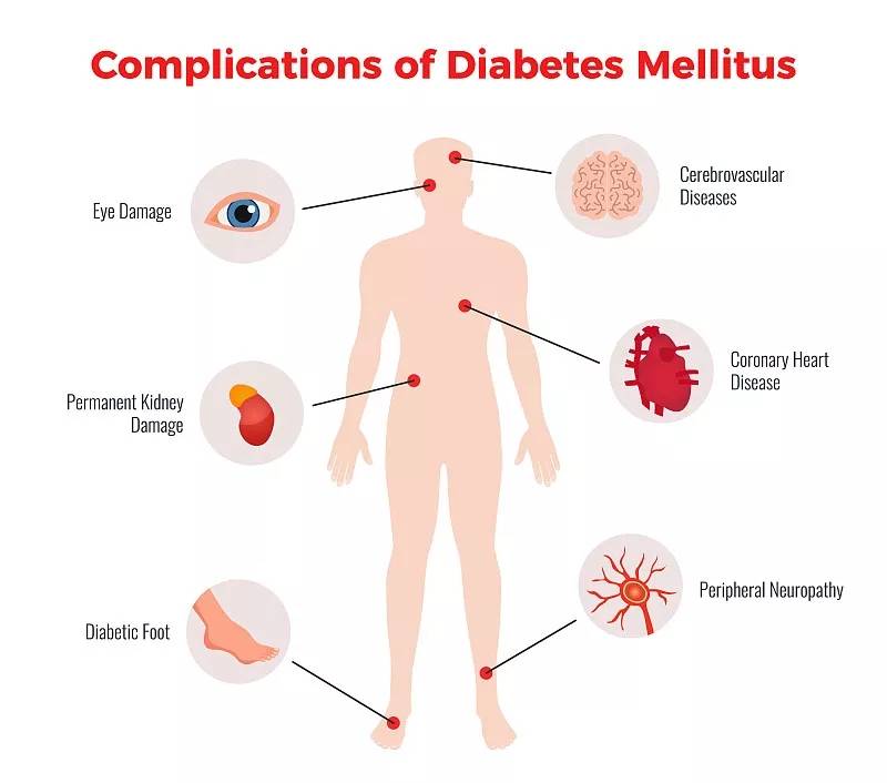 治疗|前沿:干细胞对糖尿病及其并发症的临床应用研究进展
