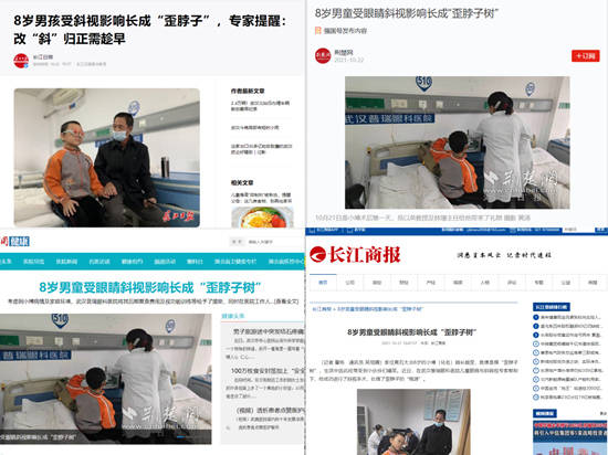 视觉|斜视的治疗方法有哪些?术后需要视觉训练吗?武汉普瑞眼科医院林珊解答