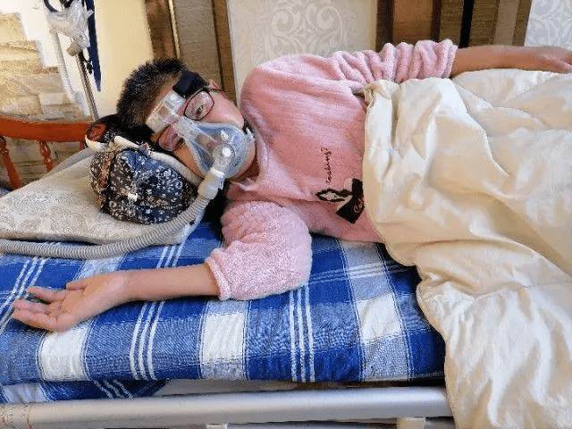 治疗|造成的运动神经元病的因素有哪些