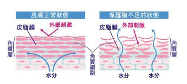 的表面洗完脸皮肤干燥紧绷起皮怎么办？做对这三件事，重新找回水嫩肌！