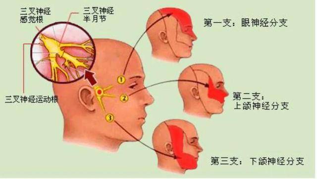 疱疹的后遗症神经痛能治好吗 dc135beed3444caa9fbe8c980064ea64.jpeg