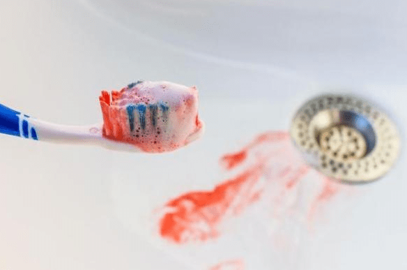 症状|身上2处“发痒”，别再傻傻以为是皮肤过敏，肝脏或早已“烂如渔网”