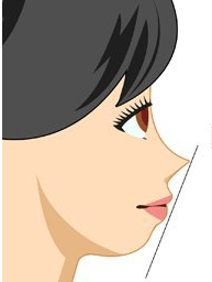 看三庭的距离,下巴应处于鼻尖到嘴唇的连线上,侧面看才会有协调的美感