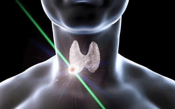 治疗|甲状腺专家王占荣分享：三分钟了解甲状腺功能异常的表现，以及治疗方法