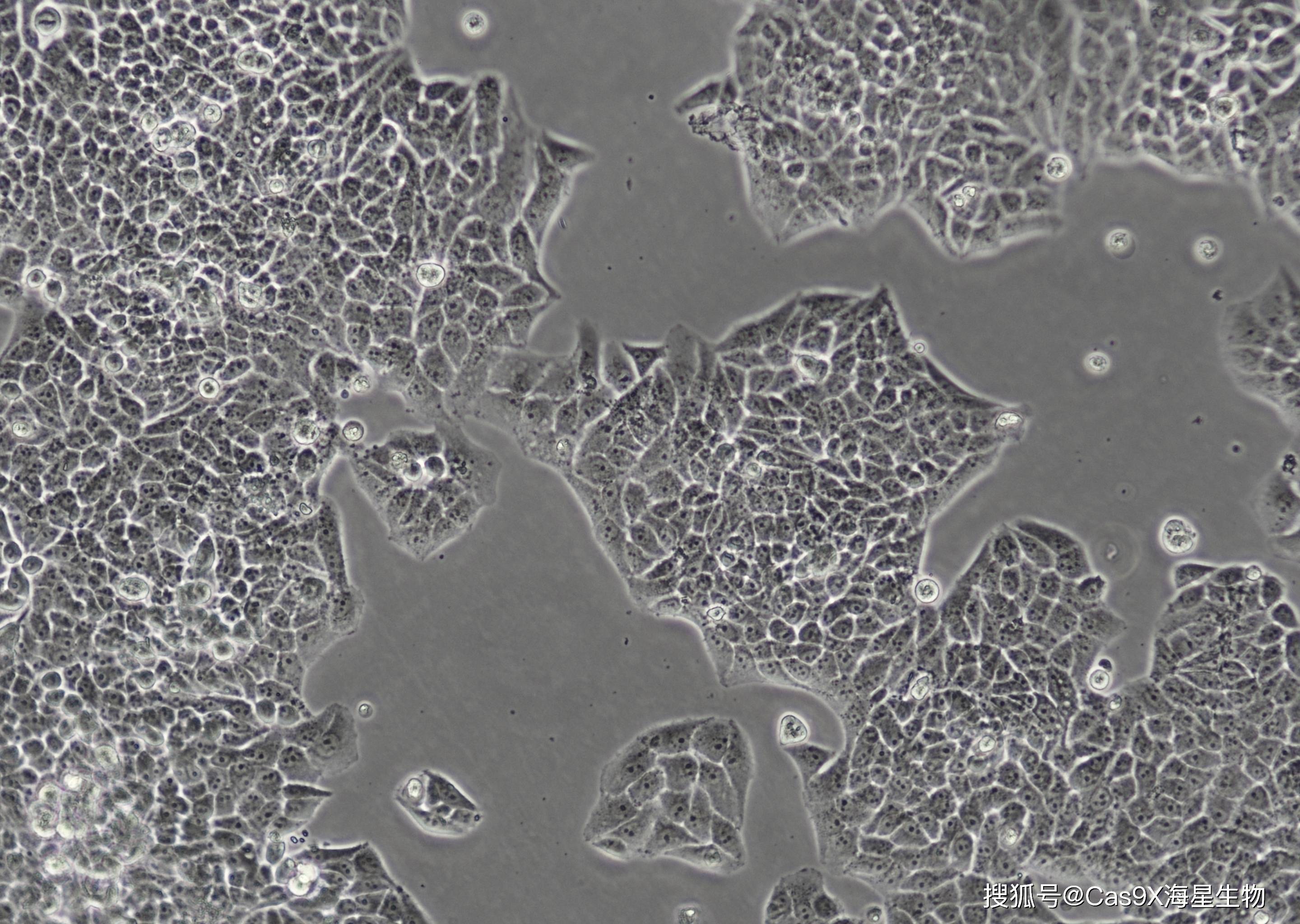 海拉细胞实物图图片
