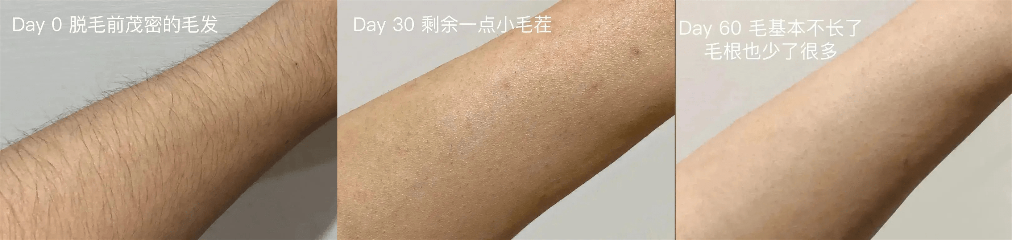 原罪长胡子不是女生“原罪”，让Ulike脱毛仪来为你解决烦恼