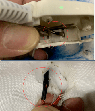 1岁男童尿床被电热毯烧成重伤总结电热毯的8大常见不合格项及常用检测