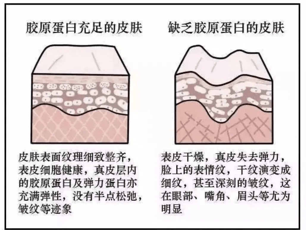 补充中科臻颜胶原魔法 胶原蛋白护肤 你有用对方法吗？