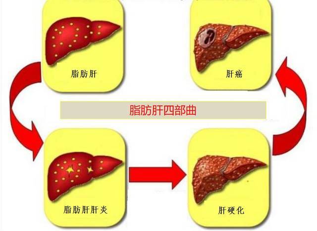 人体|遗传性肝病