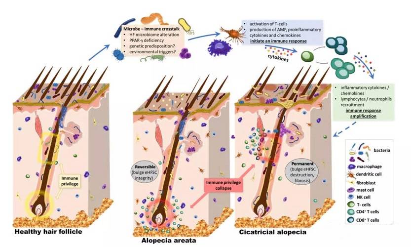 域发浅说头皮微生态与脱发