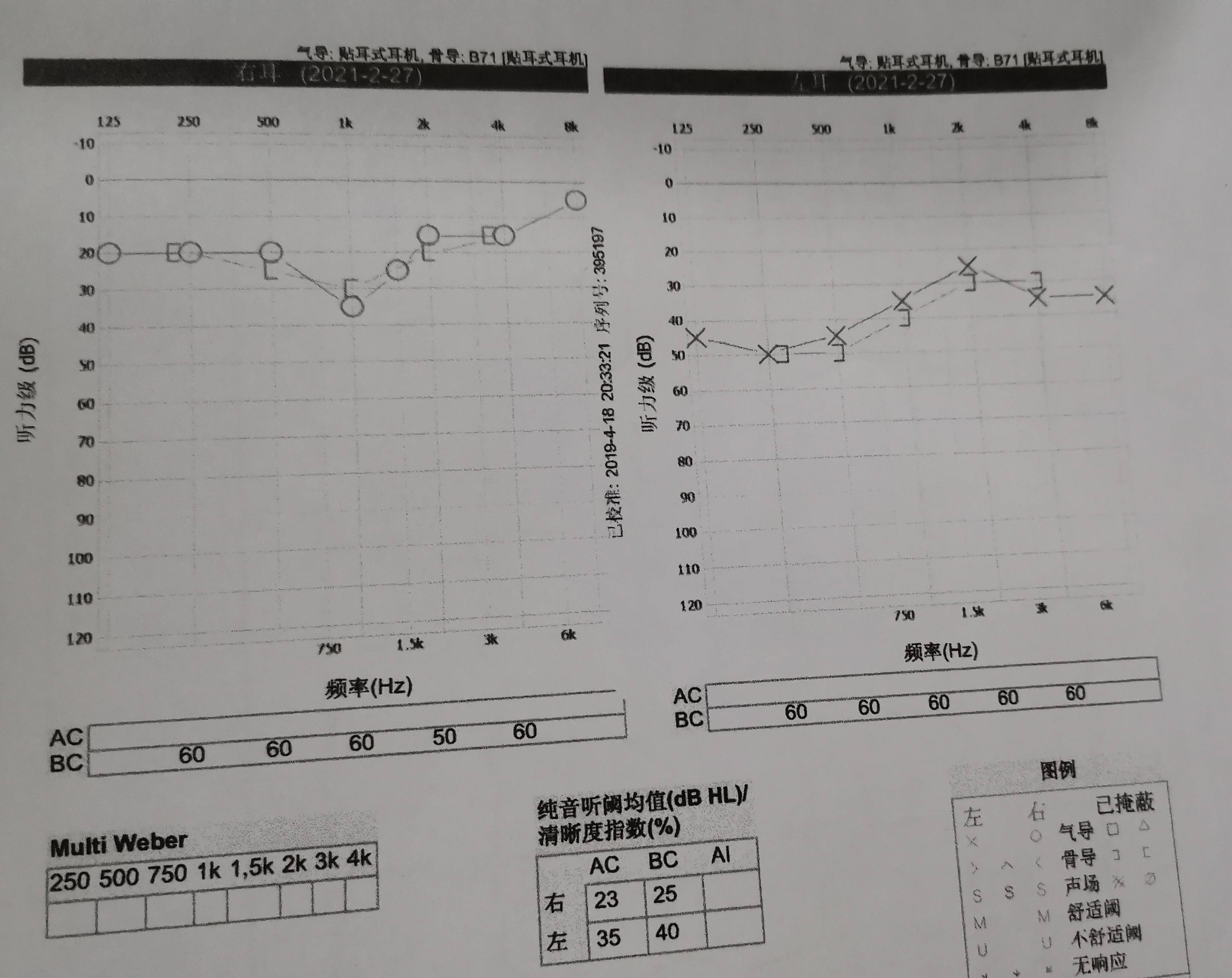 听力检查报告正常图片图片