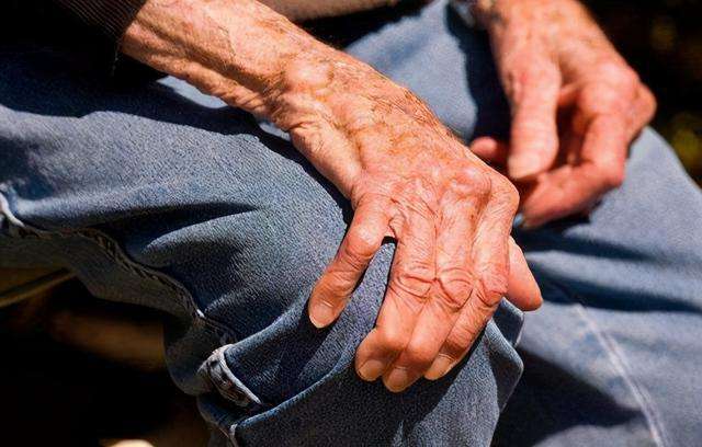 重症肌无力的症状特点有哪些?_患者_治疗_影响