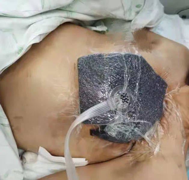 手术后刀口会很疼吗 08e981a6e45c4fce9a6cb2f60023181e.jpeg