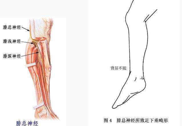 尺神經損傷後如何康復鍛鍊廣州和諧醫院為你介紹