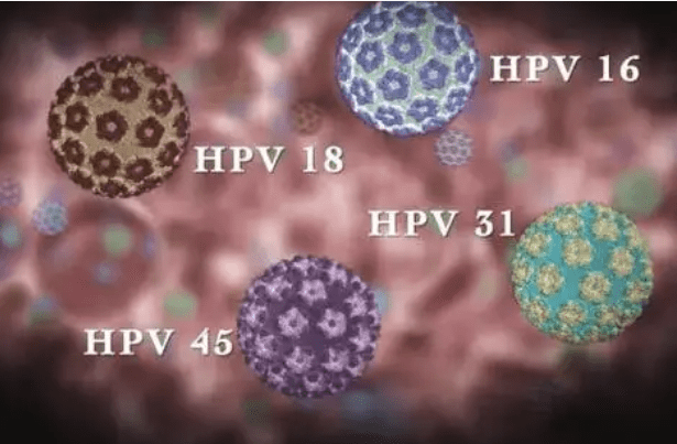 搜狐医药 | 世卫组织称HPV疫苗打一针即可，肯尼亚两千人研究支持