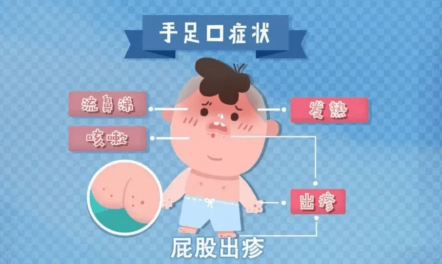 也可以經接觸病人皮膚,粘膜皰疹液而感染,3歲及3歲以下寶寶