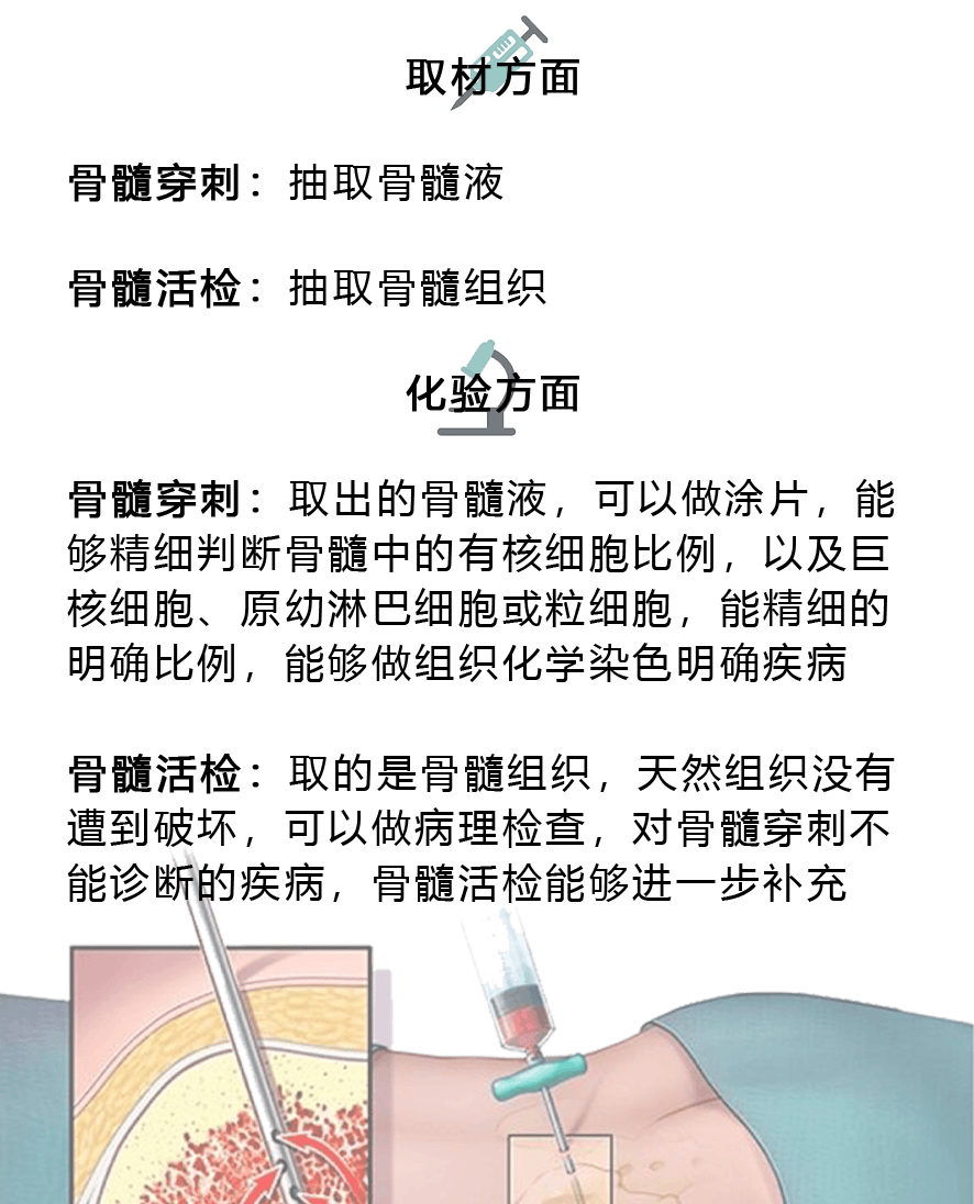 虽然骨髓穿刺和骨髓活检都需要用穿刺针抽取骨髓部分样本,均属于穿刺