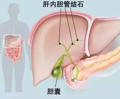胆管在人体的什么位置图片
