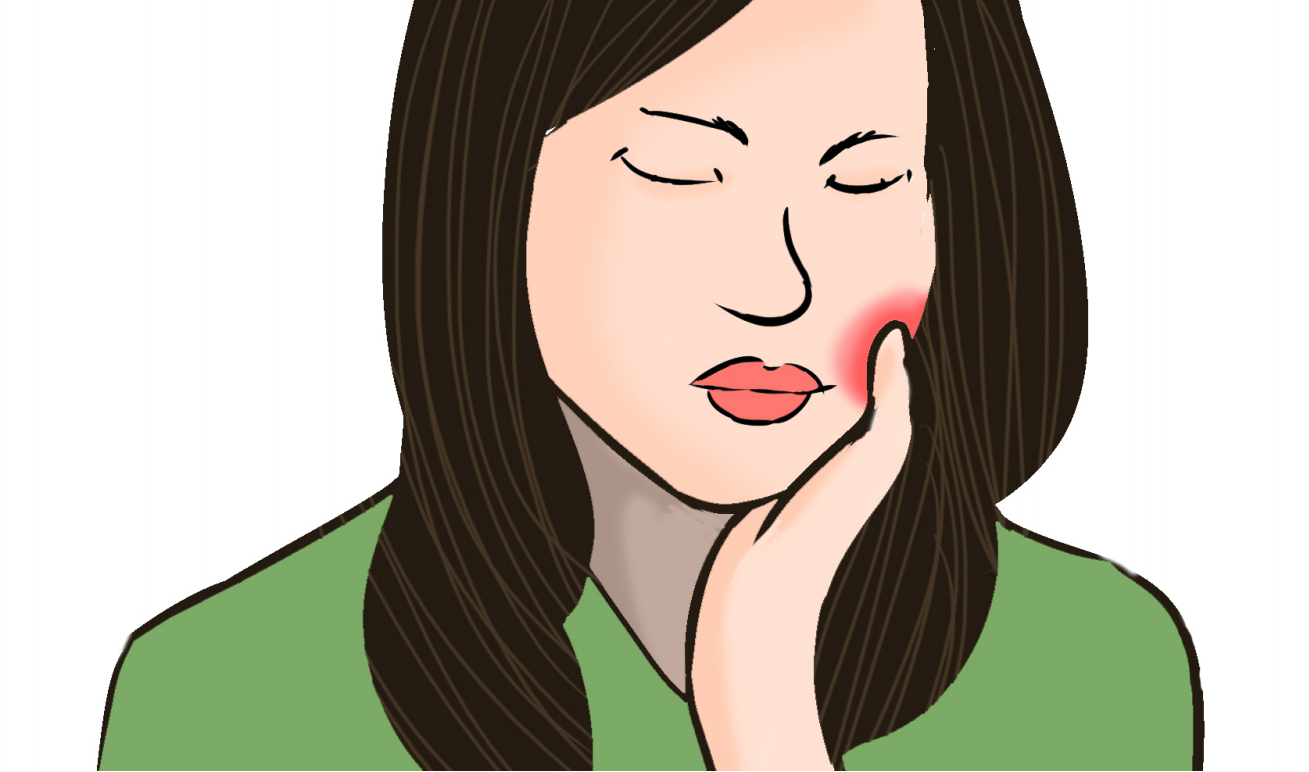 拔牙后脸肿与拔牙的过程有关,简单的牙拔除可能会无