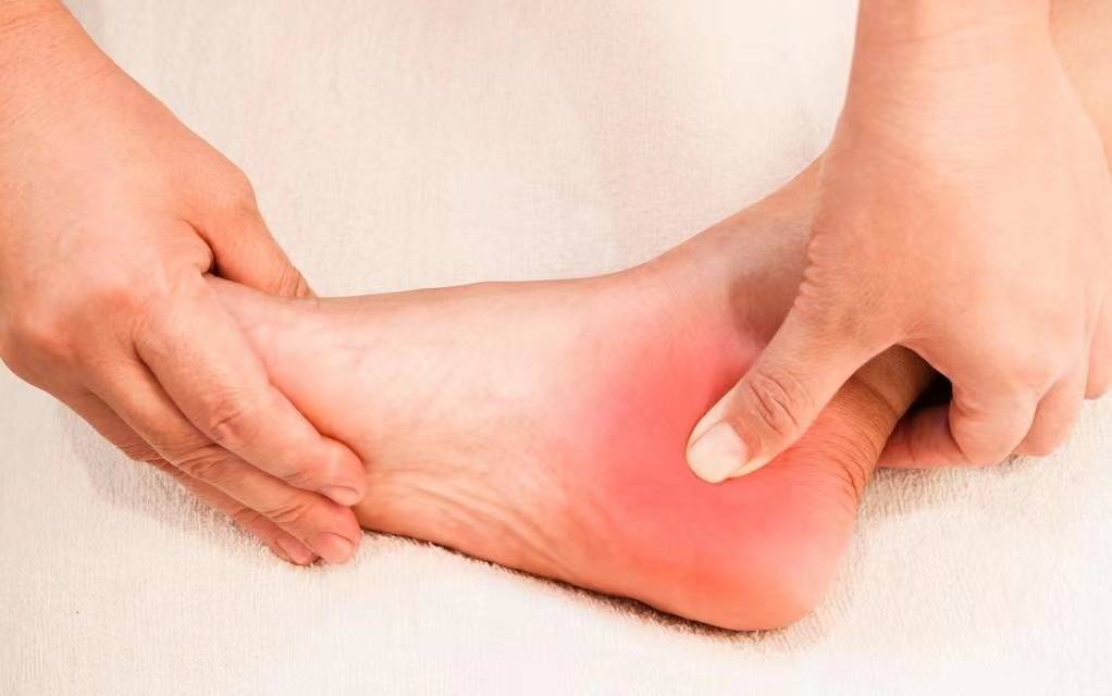 我找到了足底筋膜炎的治愈方法!简单便捷高效!_炎症_进行_毛巾