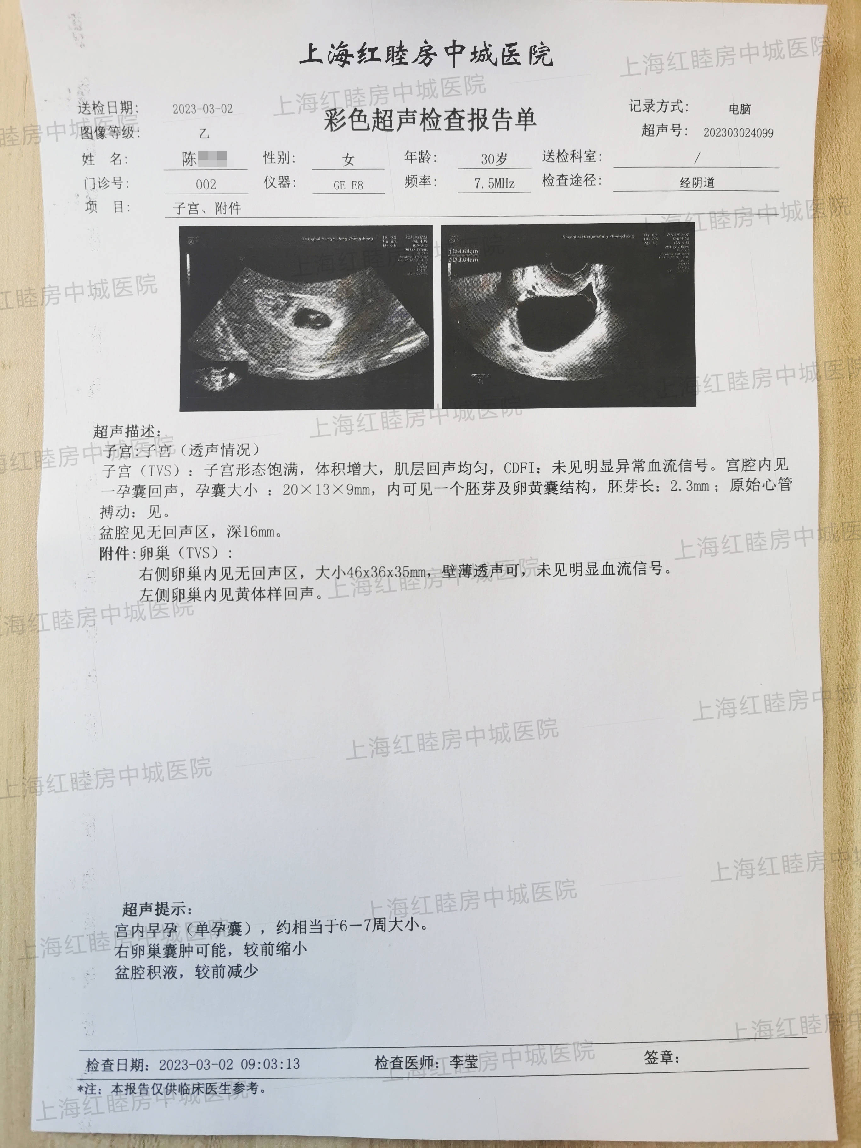 孕早期如何判斷胎兒發育是否正常?看這幾個指標_檢查_大小_影響