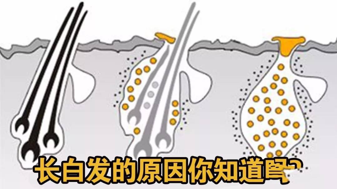 深圳70后女副区长白发照走红，鱼双双白发问题如何解决？（深圳各区女区长）
