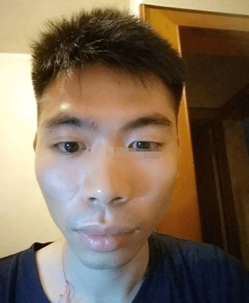 王字面的脸形是面形骨高,额骨,颤骨,腮骨三骨齐露,鼻骨直而突出.