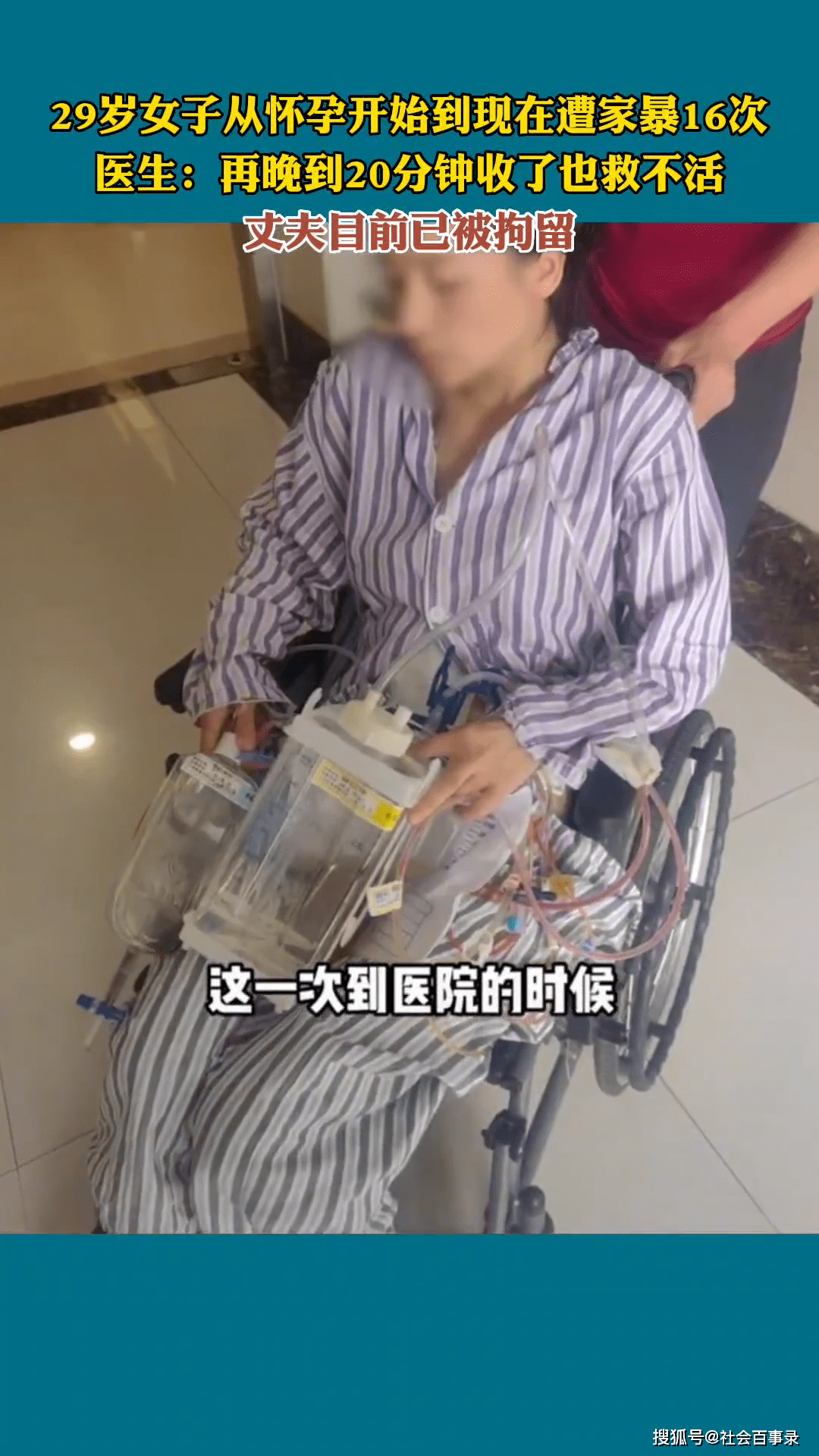 女子怀孕期间被家暴16次,内脏器官受损需终身挂粪袋_女士_贺某_老公