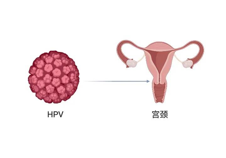 女性hpv病毒早期症状图片