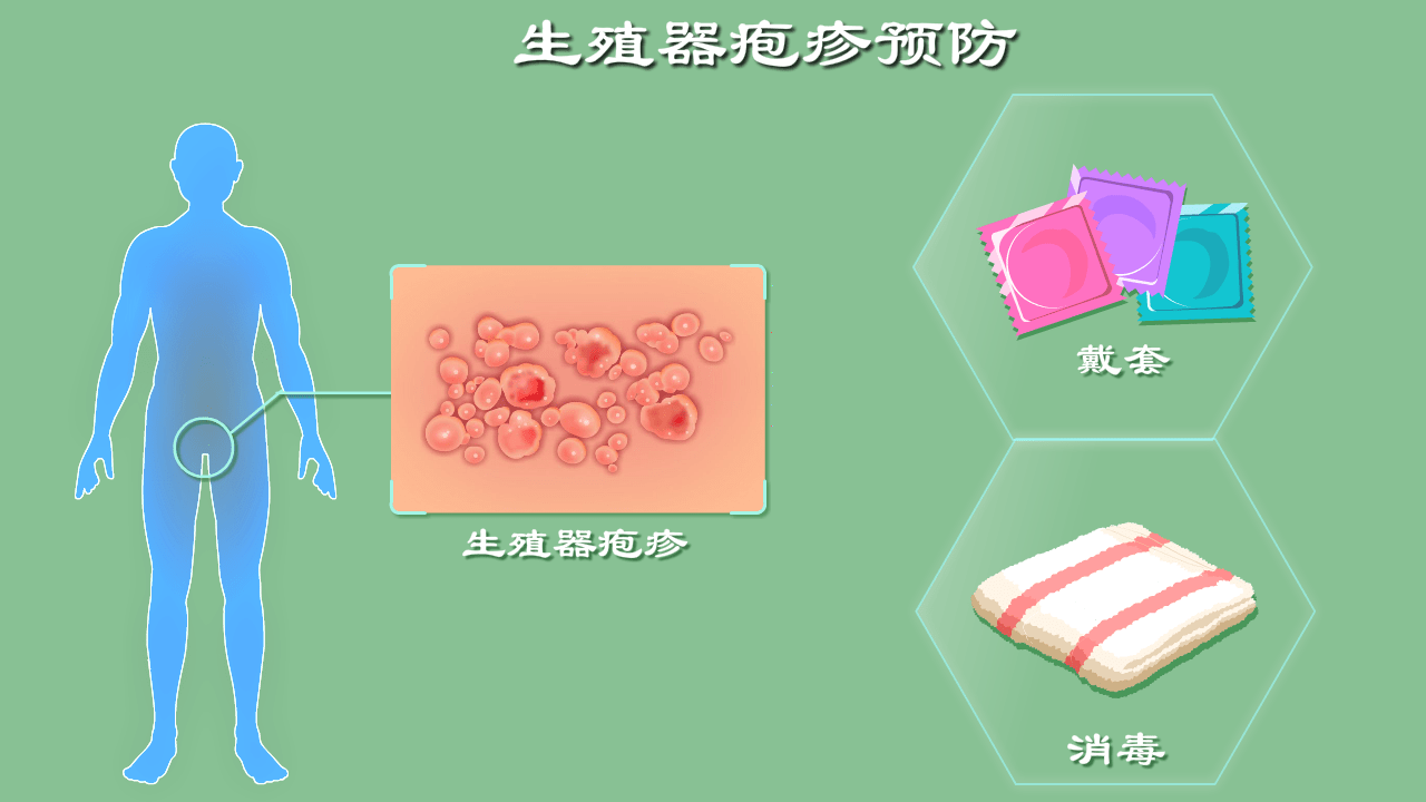 鄭州合心醫院科普:生殖器皰疹發病機理_病毒_臨床_感覺神經