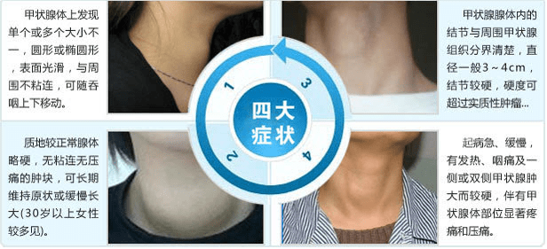 甲减症状表现甲亢病是什么病甲状腺结节的恶变症状北京丰台广济医院