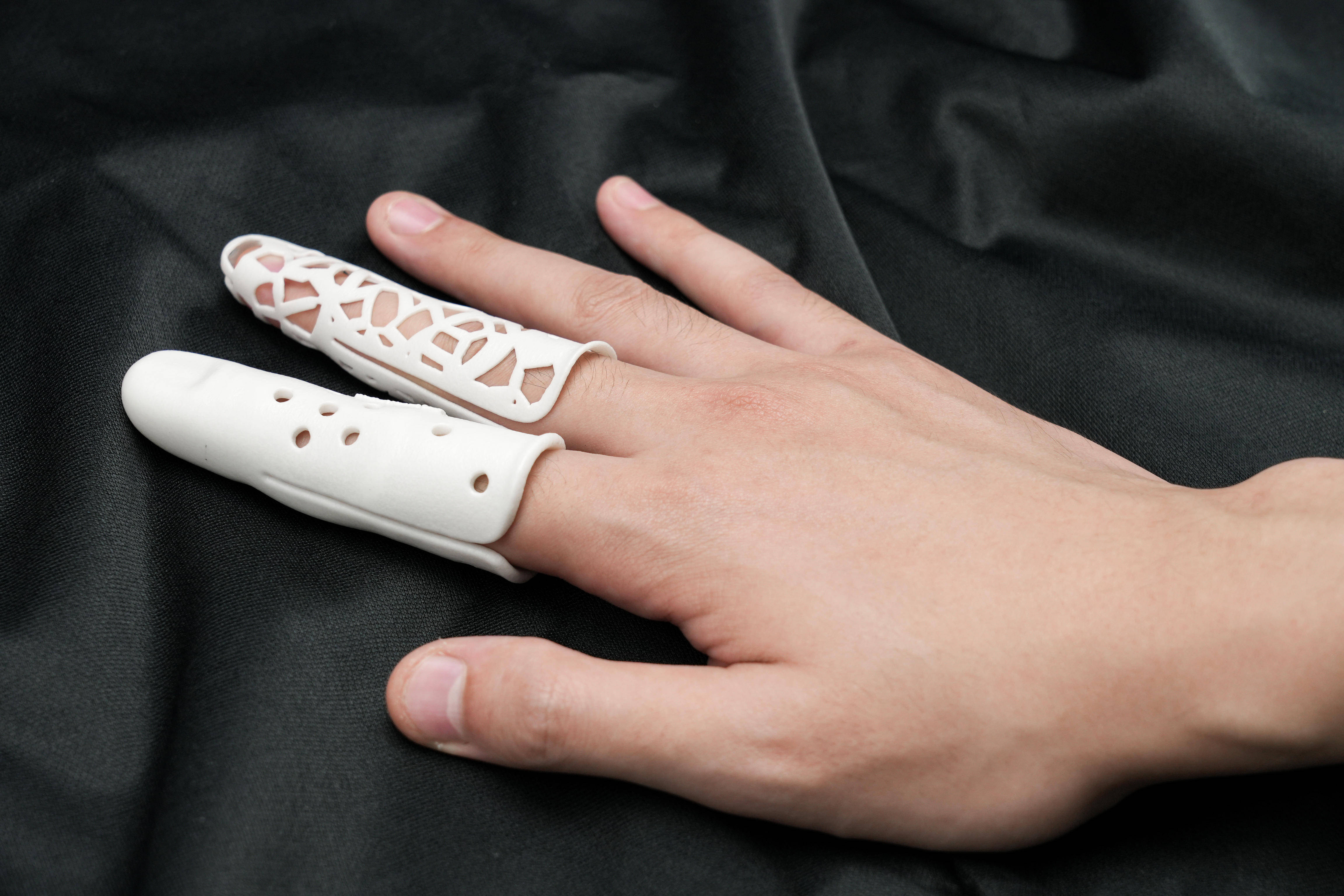 3d打印手指矫形器——应用受伤,疾病或先天性缺陷而导致手指畸形的