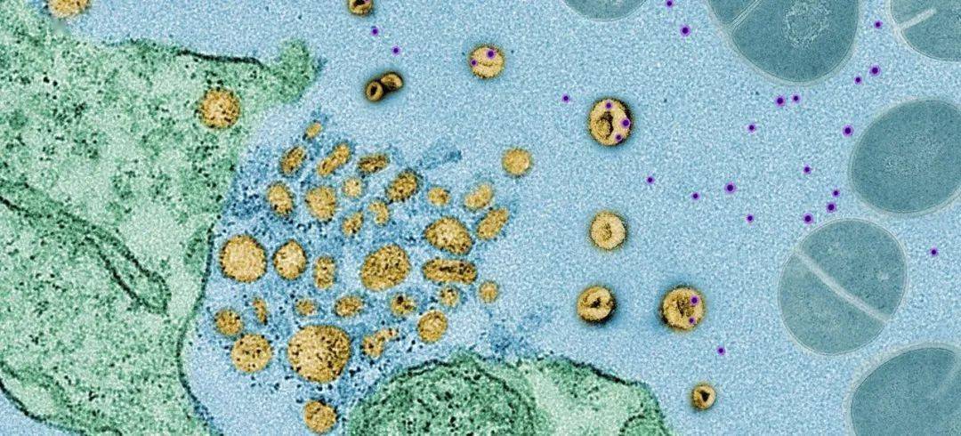 自然 超神奇的全新免疫機制 科學家首次發現普通細胞會釋放外泌體作為誘餌 誘捕併中和超級細菌釋放的殺傷性毒素 亞洲癌症研究基金會有限公司